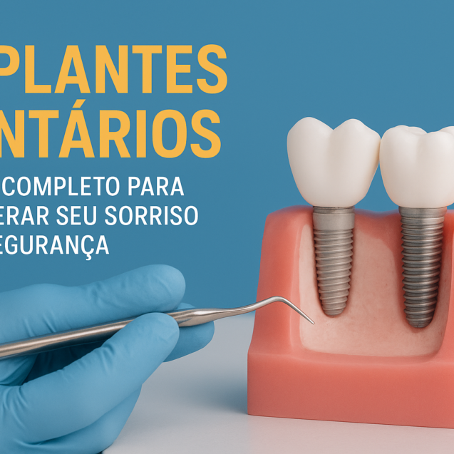 Implate Imagem ilustrativa - Odontologia Vila Real